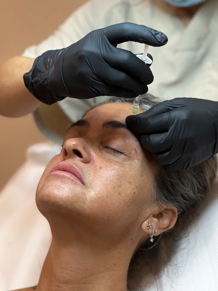 Aplicación de toxina botulínica en Lumea